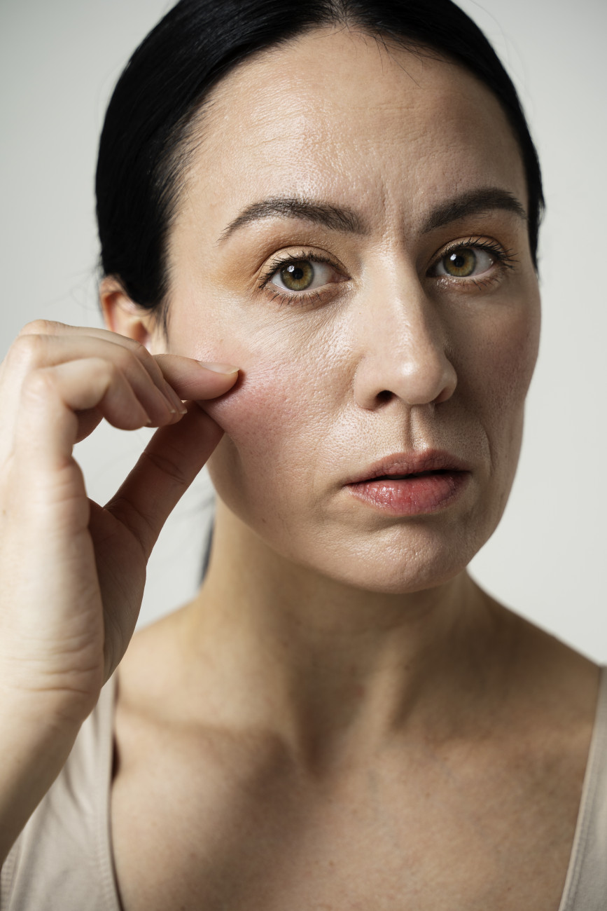 Brunette Woman Holding Her Cheek